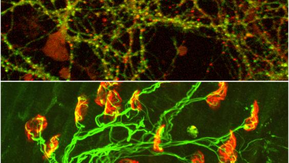 EphA4蛋 白 调 节 神 经 系 统 的 可 塑 性	