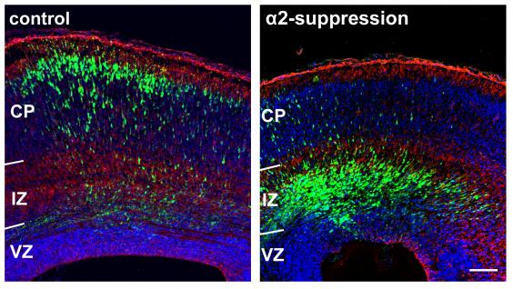 圖 示 正 常 大 腦 神 經 細 胞 遷 移 （ 左 ） 及 α2-chimaerin 抑 制 導 致 大 腦 神 經 細 胞 遷 移 異 常 （ 右 ） ， 螢 光 綠 色 部 分 為 神 經 細 胞 。	