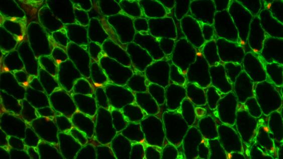 A cross section of skeletal muscle tissue with muscle fibers shown in green and the muscle stem cells shown in red.
