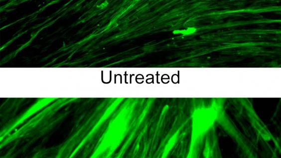  Muscle fibers were significantly increased in the AARS splice-variants-treated human skeletal muscle cells (below).