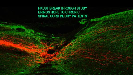 New scientific treatment gives hope to chronic spinal cord injury patients